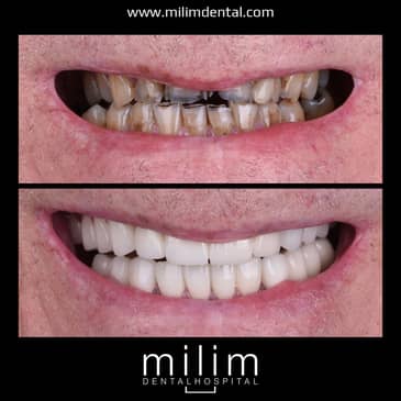 Slider image (7) Milim Dental